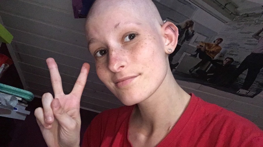 Chloé, jeune adulte ayant perdu ses cheveux et faisant le signe de la victoire après son combat contre le cancer