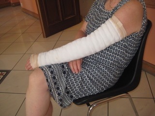 photo d'un bras avec un système de compression pour le traitement du lymphœdème