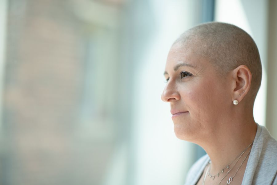 Femme ayant perdu ses cheveux après chimio illustrant l'importance des solutions capillaires comme le foulard chimio